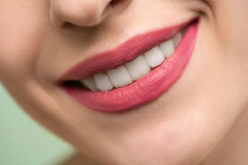 Primer plano de una sonrisa tras un tratamiento de estética dental